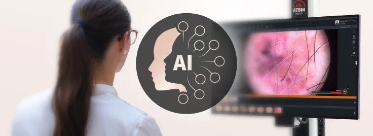 Digitale Hautkrebsvorsorge mit AI